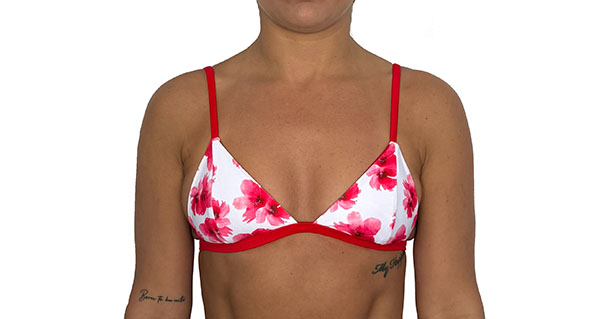 אפרודיטה מקובעת